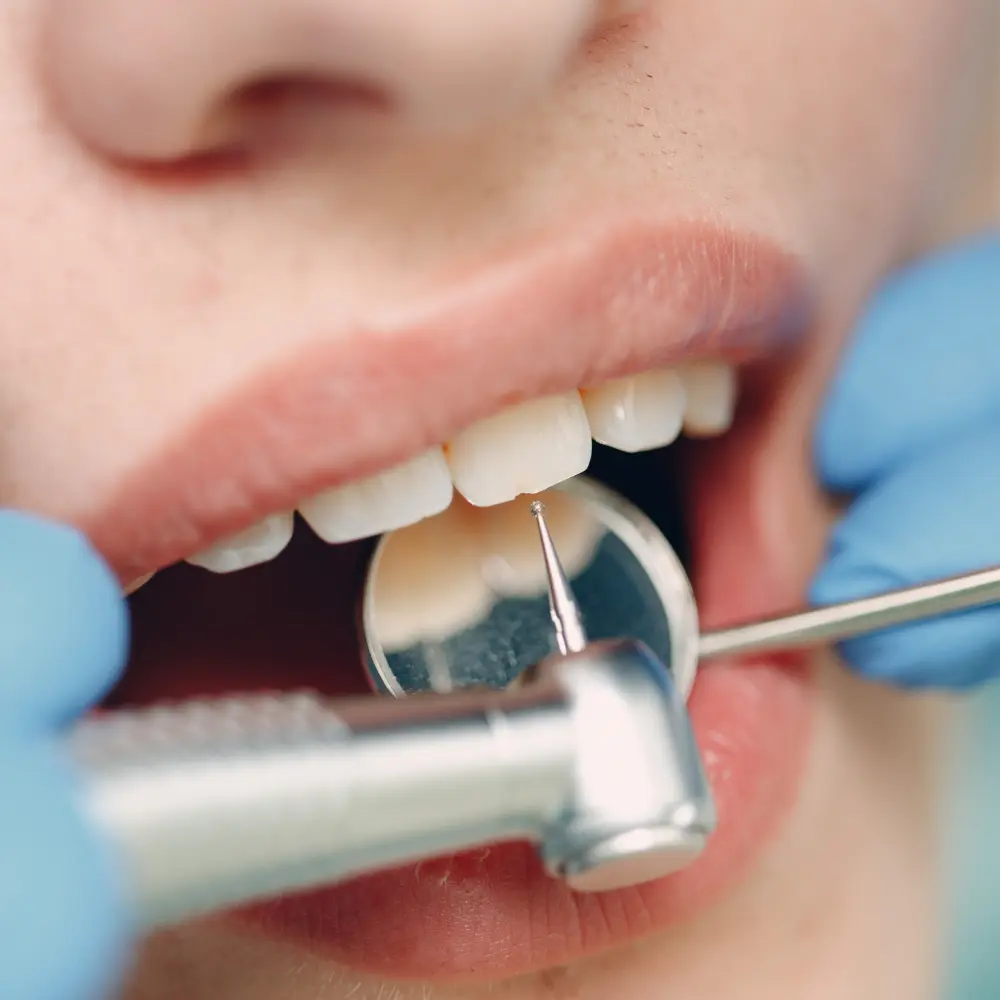 dentista-en-oviedo