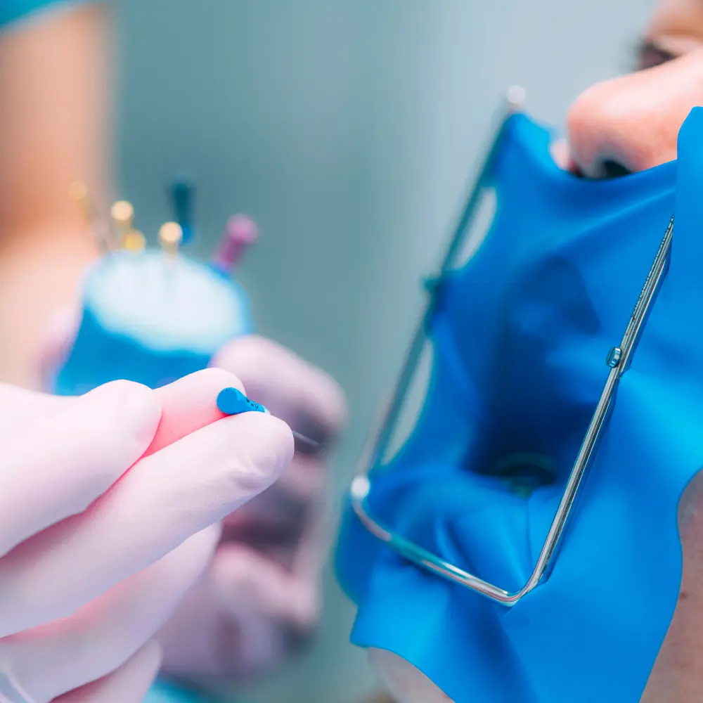 endodoncia