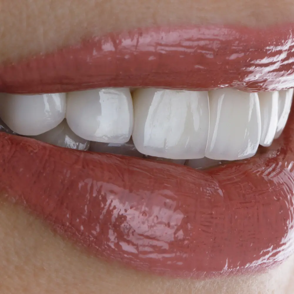 estetica-dental