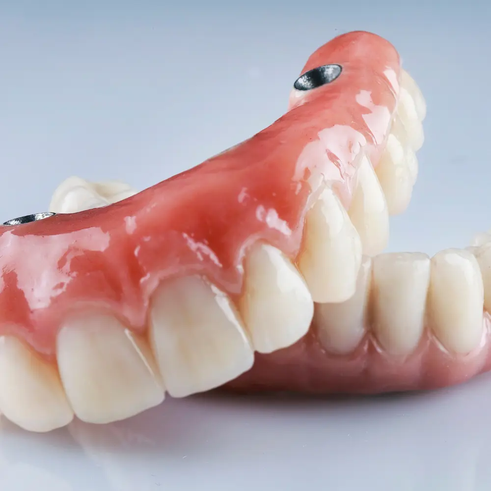 protesis-dentales